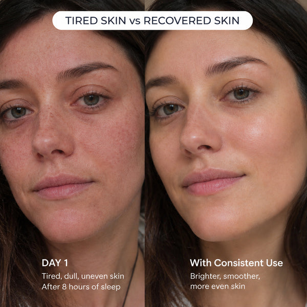 Real women. Real recovery.