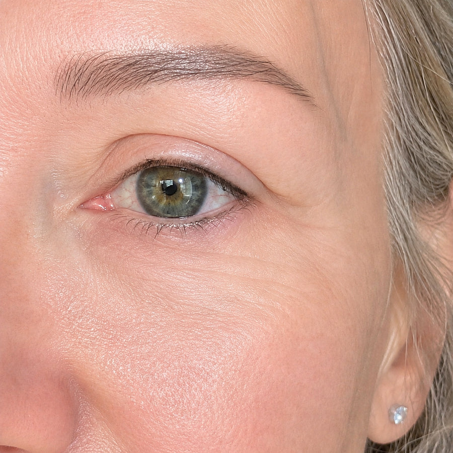 A healthier-looking complexion